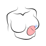 5-Speed Multiple-Frequency Clitoral Suction Egg