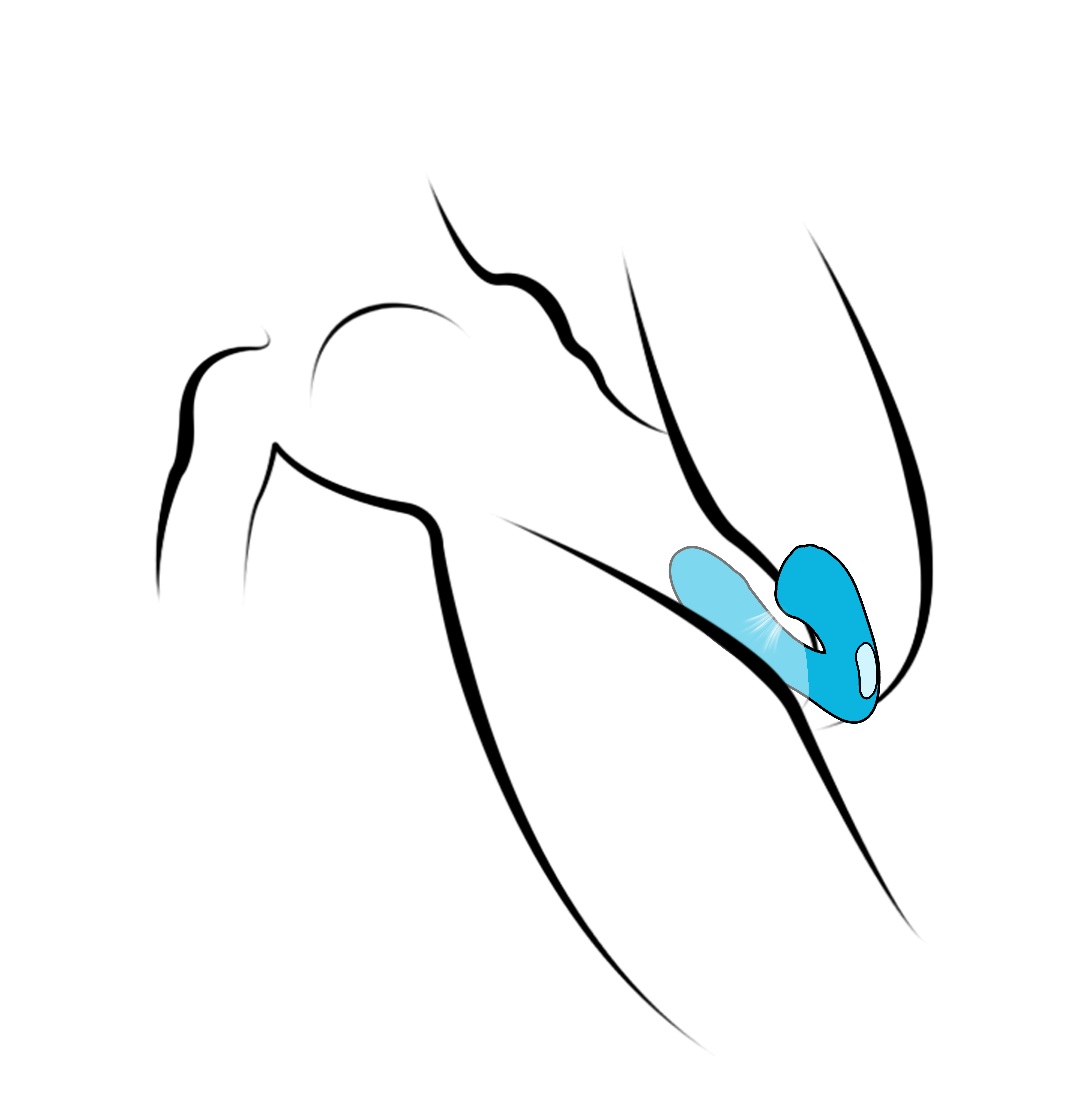Remote-Controlled Wearable Clitoral Suction Vibrator